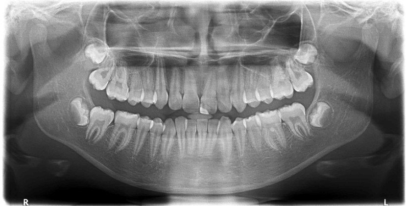 Dental X-Ray Services